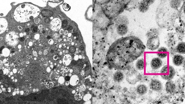 Ce que nous savons sur la réinfection à la COVID-19 à l’ère Omicron