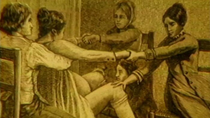 Illustration d'époque montrant une femme en travail, assise sur une chaise avec un homme qui la tient sous les bras. Une sage-femme est agenouillée à ses pieds et deux autres femmes lui tiennent les mains.