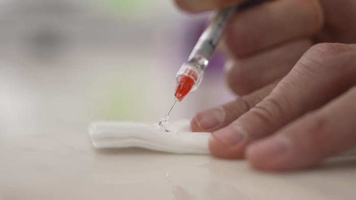 De l'agent de comblement sort du bout de la seringue.