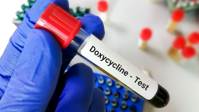 Prise de sang avec la mention «doxycycline» dans la main d'un scientifique.