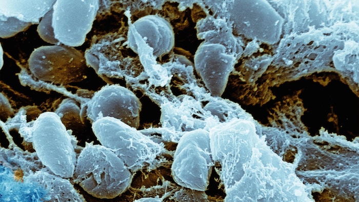 Le bacille Yersinia pestis à l'origine de la peste pulmonaire.