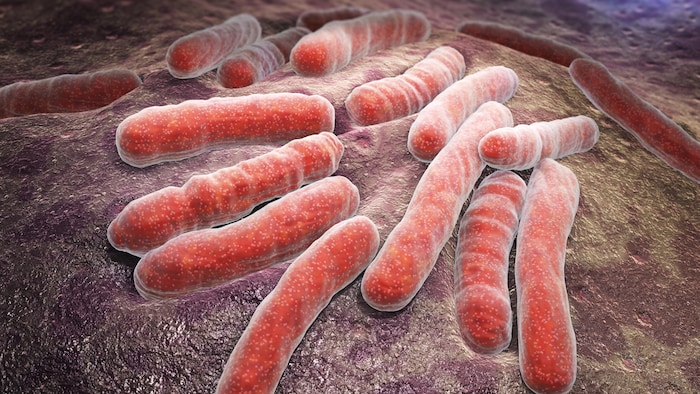 La bactérie de la tuberculose.