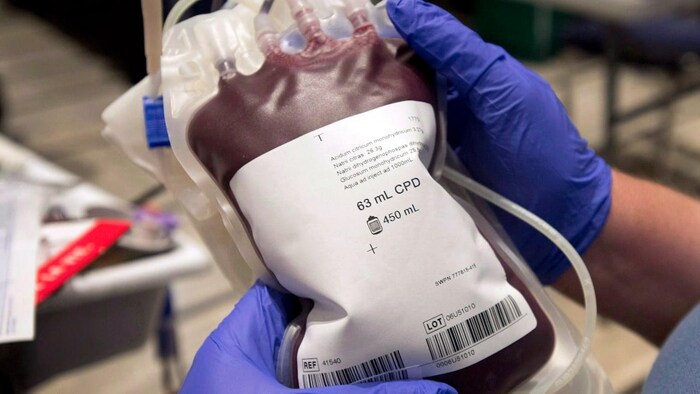 Un sac rempli de sang dans les mains d'une personne.