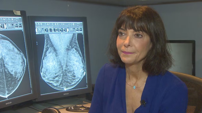 La Dre Paula Gordon, professeure clinique à l'Université de Colombie-Britannique et radiologue spécialisée dans le cancer du sein, affirme que la désinformation en ligne peut dissuader les femmes de profiter de l'abaissement de l'âge requis pour passer une mammographie.
