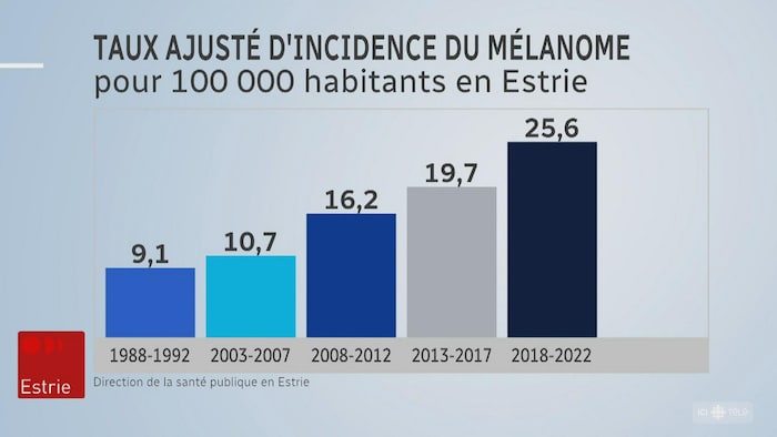 Tableau du taux ajusté d'incidence du mélanome determination 100 000 habitants en Estrie. Entre 1988 et 2022, le taux ajusté d'incidence du mélanome est passé de 9 par 100 000 habitants à près de 26 determination 100 000 habitants, presque trois fois plus.