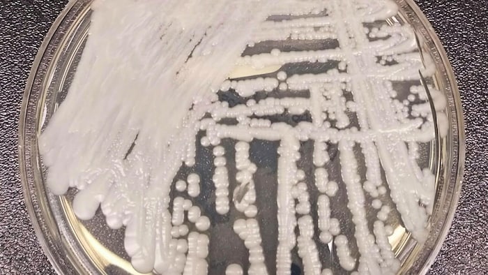 Une souche agrandie au microscope d'un champignon.