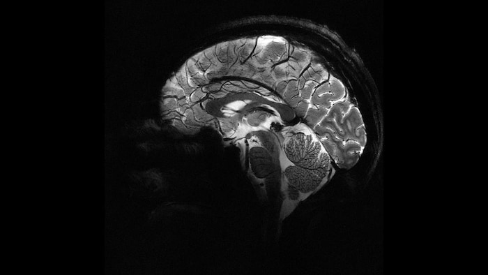 l-irm-le-plus-puissant-du-monde-pr-t-percer-les-myst-res-du-cerveau