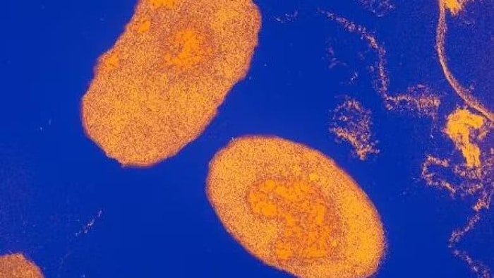 Image au microscope de la bactérie « Bordetella pertussis », responsable de la coqueluche.