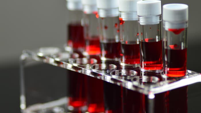 Éprouvettes utilisées à des fins de tests sanguins en laboratoire. 