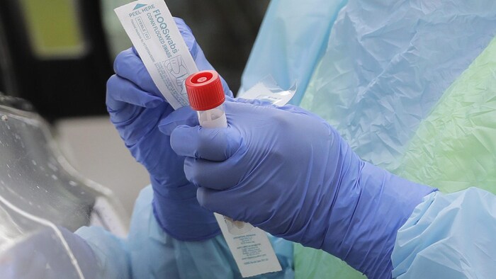 Un tube tenu par une infirmière qui porte des gants médicaux bleus.