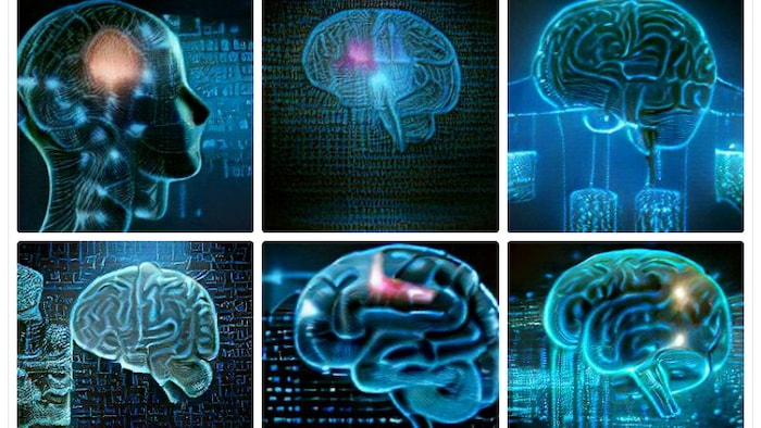 Des images de cerveau en bleu et vert.