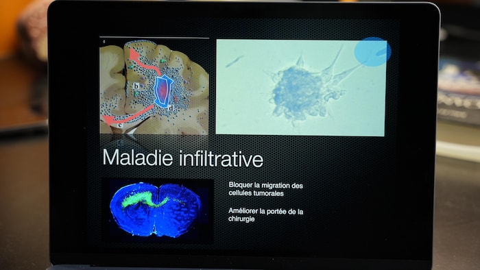 Des images de cerveau sur un écran d'ordinateur.