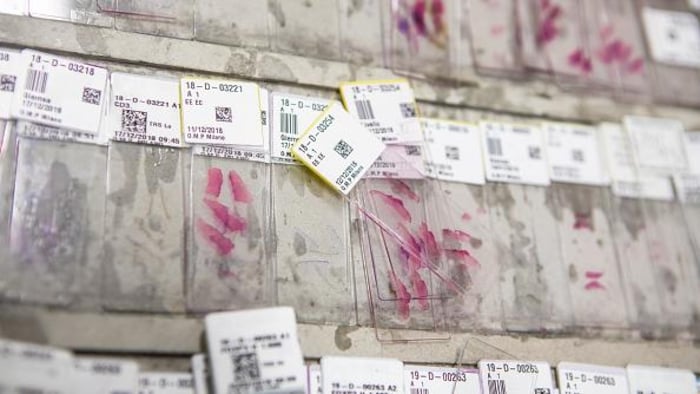 Des lames d'échantillons médicaux.