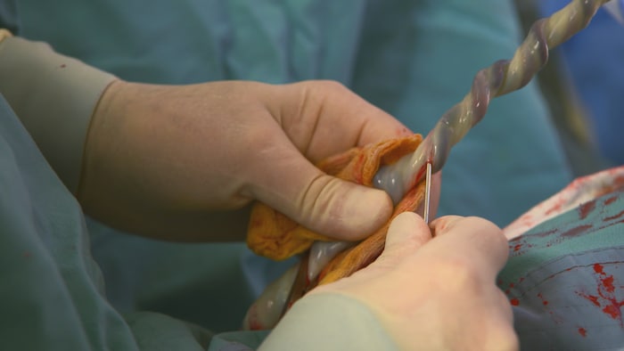 Des mains tiennent un cordon ombilical dans une salle de naissance.