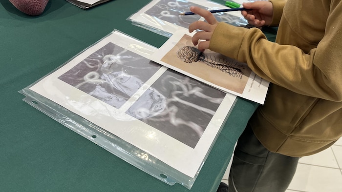 Un enfant tient un crayon au-dessus d'images médicales.