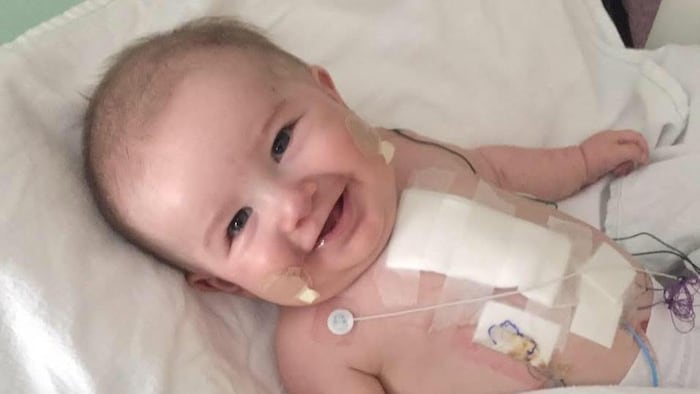 Un bébé souriant sur un lit d'hôpital. Il a des pansements sur sa poitrine.