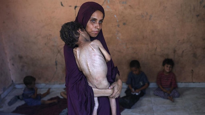 Une mère porte son fils mal en point en raison de la malnutrition.