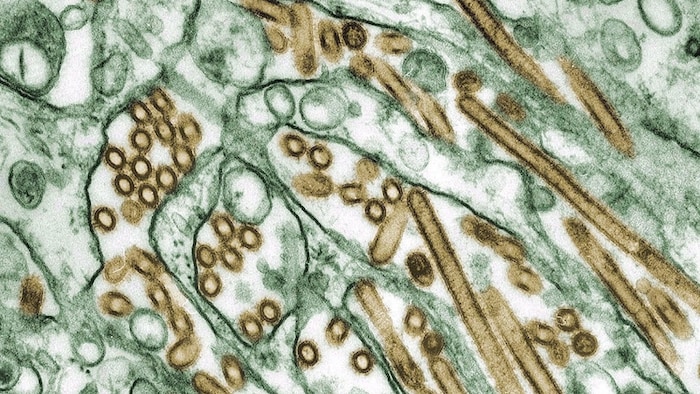 Une image de cellules de la grippe aviaire.