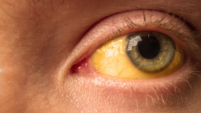 Gros plan sur un oeil dont le fond est de couleur jaune.
