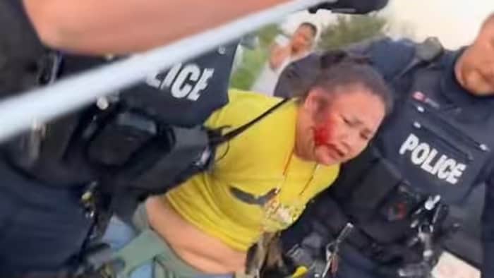 Une capture d'écran de la vidéo de l'arrestation de Rose Augus. Elle est emmenée par la police, le visage blessé.