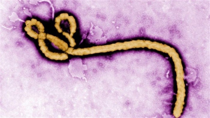 Gros plans sur le virus Ebola.