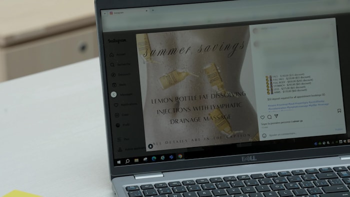 Une work  Instagram d'une clinique québécoise qui fait la promotion du Lemon Bottle.