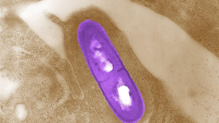 صورة مجهرية إلكترونية لبكتيريا الليستيريا في أحد الأنسجة.