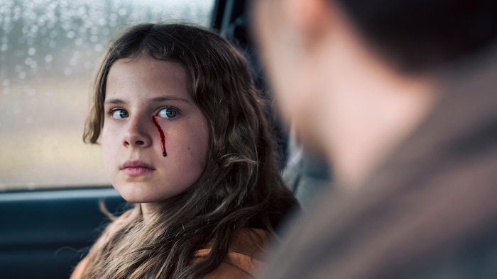 Du sang coule du coin de l'oeil d'une jeune fille assise dans une voiture.