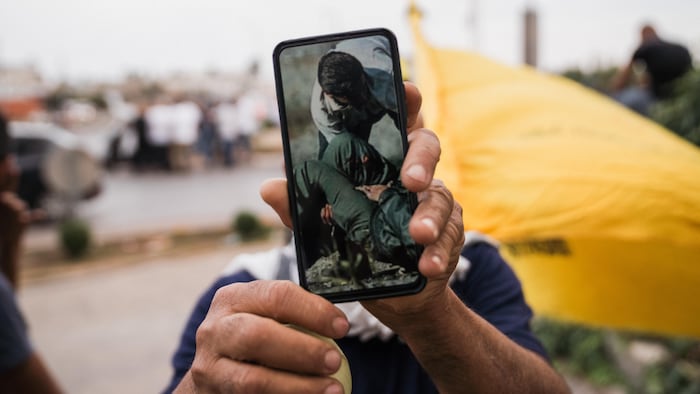 Un homme tend une vieille photo de sa jambe blessée sur son cellulaire en cachant son visage.
