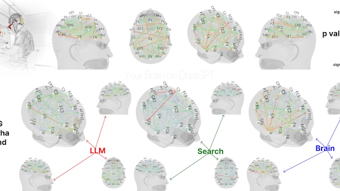 Image montrant les endroits où le cerveau est activé.
