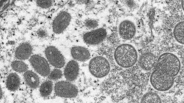 Una imagen tomada con un microscopio electrónico muestra el virus de la viruela del mono.