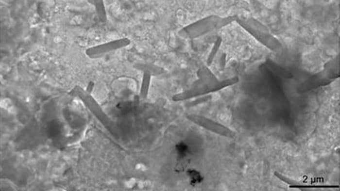 Vue au microscope de particules de plastique dans un cerveau humain.