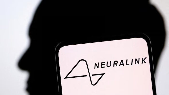 Brain implant company Neuralink says it's gotten permission from U.S. regulators to begin testing its device in people. The company is led by Elon Musk, whose silhouette is shown here behind the company's logo. 