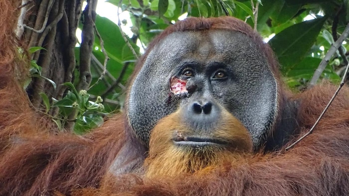 Un orang-outan de Sumatra avec une plaie au visage.