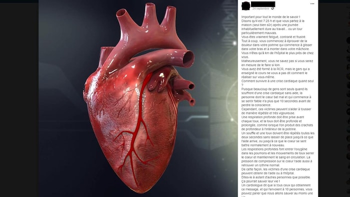 On voit une publication Facebook sur les conseils à suivre en cas de crise cardiaque.