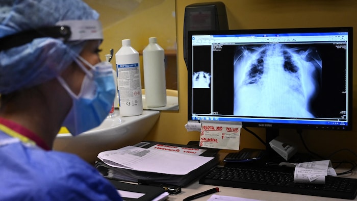 Une infimière analyse une radiographie des poumons d'un patient.