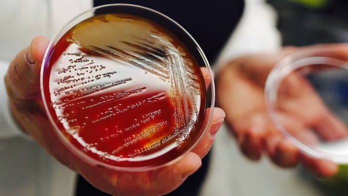 Un test en laboratoire de la bactérie.