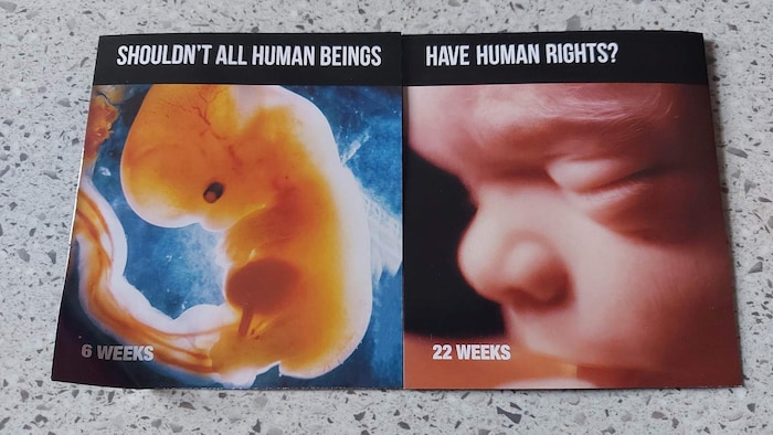 Sur un tract, deux images sont juxtaposées montrerait deux foetus à des stades différents de la grossesse. En haut du document, on peut y lire, « Tous les êtres humains ne devraient-ils pas bénéficier des droits de l'homme ? » écrit en anglais.