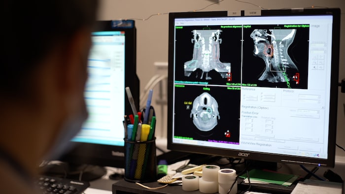 Des images médicales sur un écran d'ordinateur.