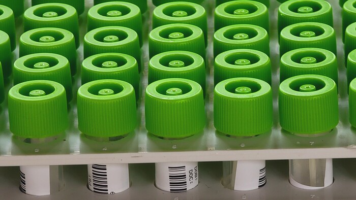 Rangée de tubes contenant des échantillons, tous fermés avec un bouchon vert pomme.
