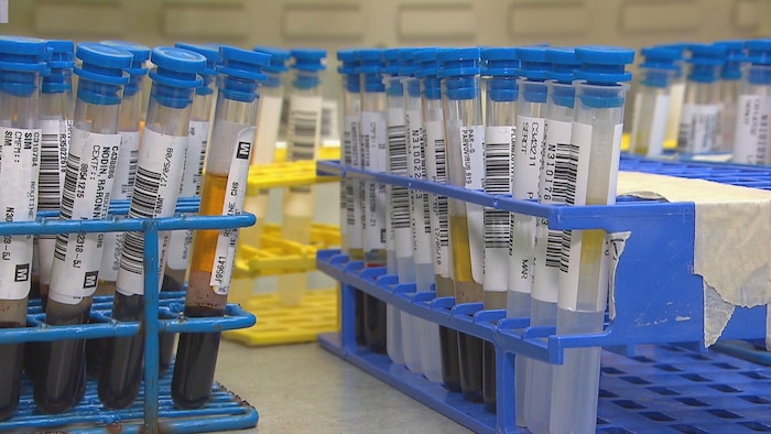 Les technologistes médicaux sont surchargés en raison du manque de personnel.