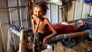 Des Centaines De Milliers D enfants Du Y men Risquent De Mourir De Faim 