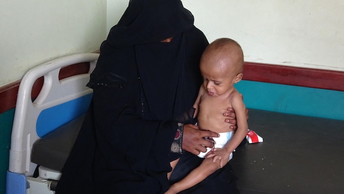 Un enfant porté par une femme au Yémen.