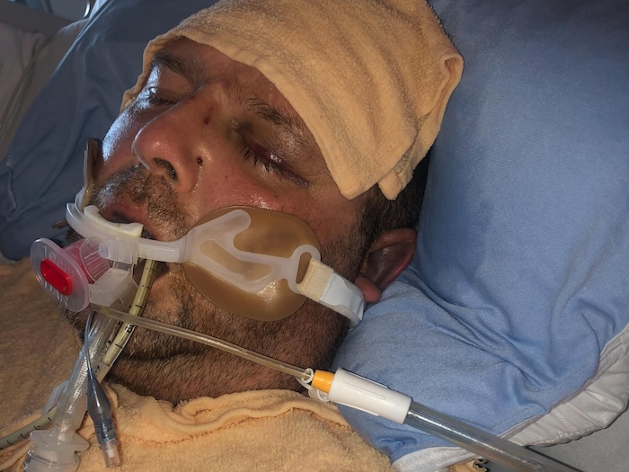 Danny Robinson intubé dans un lit d'hôpital, le visage tuméfié.