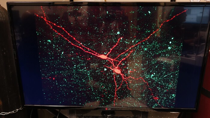 des neurones d'un cerveau de souris