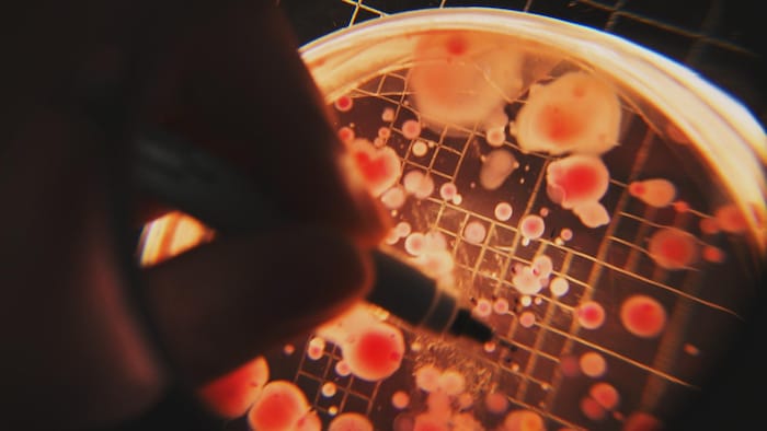 On voit des colonies de bactéries dans une boîte de Petri.