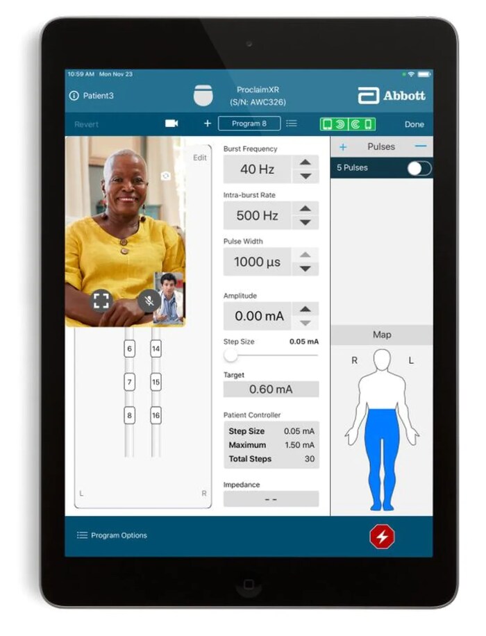 The NeuroSphere Virtual Clinic allows doctors to remotely administer deep brain stimulation to treat patients with neurological disorders like Parkinson's disease, essential tremor disorder, and epilepsy. (Abbott Laboratories)