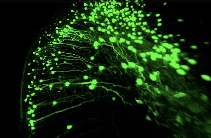 Des cellules ovoïdes.