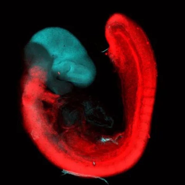 Le cerveau d'une souris de laboratoire.