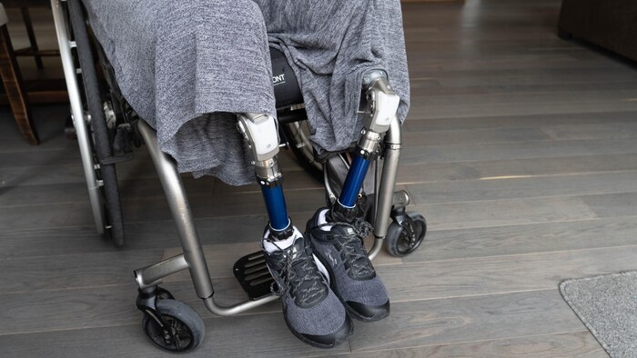 Un plan sur les deux prothèses de jambe d'une personne assise en fauteuil roulant.